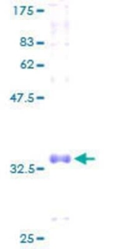 Novus Biologicals Recombinant Human COX7A1 GST (N-Term) Protein 2 &mu;g | Buy Online | Novus Biologicals&trade; | Fisher Scientific