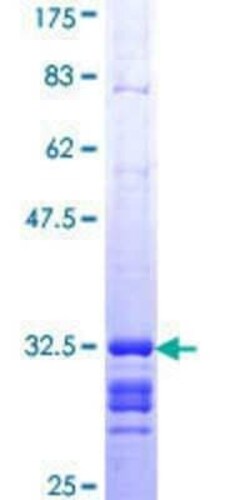Novus Biologicals Recombinant Human COX7A2 GST (N-Term) Protein 10 &mu;g | Buy Online | Novus Biologicals&trade; | Fisher Scientific