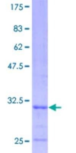 Novus Biologicals Recombinant Human COX7C GST (N-Term) Protein 25 &mu;g | Buy Online | Novus Biologicals&trade; | Fisher Scientific