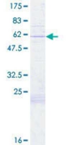 Novus Biologicals Recombinant Human COX11 GST (N-Term) Protein 2 &mu;g | Buy Online | Novus Biologicals&trade; | Fisher Scientific