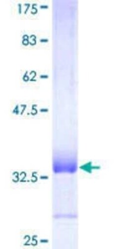 Novus Biologicals Recombinant Human COX15 GST (N-Term) Protein 25 &mu;g | Buy Online | Novus Biologicals&trade; | Fisher Scientific