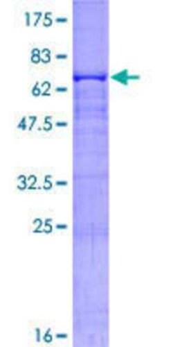 Novus Biologicals Recombinant Human Carboxypeptidase B2/CPB2 GST (N-Term) Protein 10 &mu;g | Buy Online | Novus Biologicals&trade; | Fisher Scientific