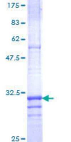 Novus Biologicals Recombinant Human Claudin-4 GST (N-Term) Protein 10 &mu;g | Buy Online | Novus Biologicals&trade; | Fisher Scientific
