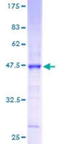 Novus Biologicals Recombinant Human Claudin-3 GST (N-Term) Protein 25 &mu;g | Buy Online | Novus Biologicals&trade; | Fisher Scientific
