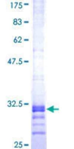 Novus Biologicals Recombinant Human Claudin-7 GST (N-Term) Protein 25 &mu;g | Buy Online | Novus Biologicals&trade; | Fisher Scientific