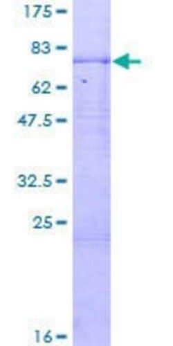 Novus Biologicals Recombinant Human CPN1 GST (N-Term) Protein 2 &mu;g | Buy Online | Novus Biologicals&trade; | Fisher Scientific