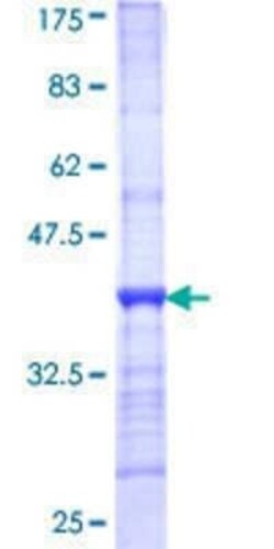 Novus Biologicals Recombinant Human CPS1 GST (N-Term) Protein 25 &mu;g | Buy Online | Novus Biologicals&trade; | Fisher Scientific