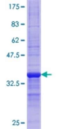 Novus Biologicals™ Recombinant Human CPT1A GST (N-Term) Protein