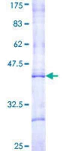 Novus Biologicals Recombinant Human CPT1B GST (N-Term) Protein 25 &mu;g | Buy Online | Novus Biologicals&trade; | Fisher Scientific