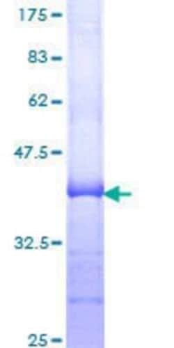 Novus Biologicals™ Recombinant Human CPT2 GST (N-Term) Protein