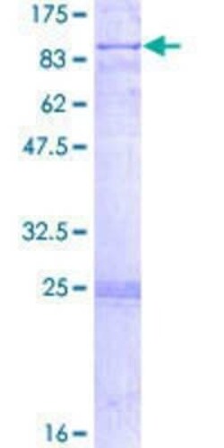 Novus Biologicals Recombinant Human CRAT GST (N-Term) Protein 2 &mu;g | Buy Online | Novus Biologicals&trade; | Fisher Scientific