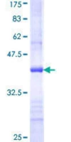 Novus Biologicals Recombinant Human CRAT GST (N-Term) Protein 25 &mu;g | Buy Online | Novus Biologicals&trade; | Fisher Scientific