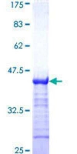 Novus Biologicals Recombinant Human CREB GST (N-Term) Protein 25 &mu;g | Buy Online | Novus Biologicals&trade; | Fisher Scientific