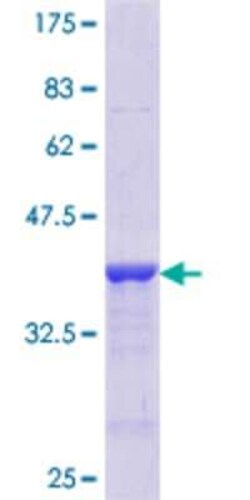 Novus Biologicals Recombinant Human CREB GST (N-Term) Protein 10 &mu;g | Buy Online | Novus Biologicals&trade; | Fisher Scientific