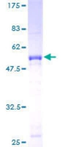 Novus Biologicals Recombinant Human ATF2 GST (N-Term) Protein 25 &mu;g | Buy Online | Novus Biologicals&trade; | Fisher Scientific