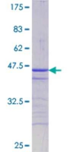 Novus Biologicals Recombinant Human ATF2 GST (N-Term) Protein 25 &mu;g | Buy Online | Novus Biologicals&trade; | Fisher Scientific