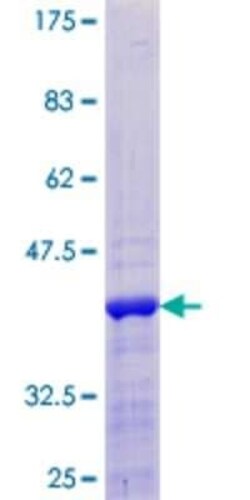 Novus Biologicals Recombinant Human CREBL2 GST (N-Term) Protein 10 &mu;g | Buy Online | Novus Biologicals&trade; | Fisher Scientific