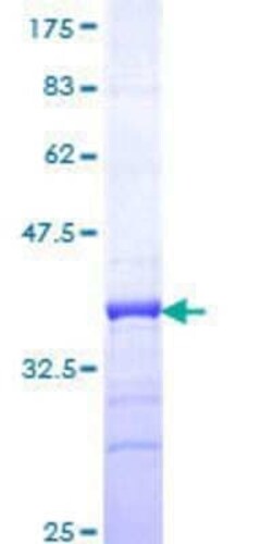 Novus Biologicals Recombinant Human CREBL2 GST (N-Term) Protein 25 &mu;g | Buy Online | Novus Biologicals&trade; | Fisher Scientific