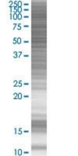 Novus Biologicals CREBL2 293T Cell Transient Overexpression Lysate 0.1 mL | Buy Online | Novus Biologicals&trade; | Fisher Scientific