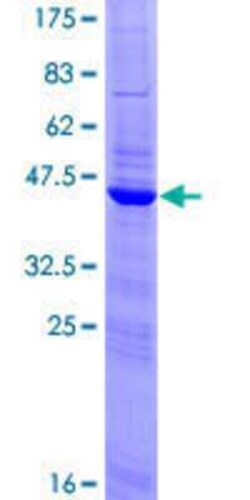 Novus Biologicals Recombinant Human CREM GST (N-Term) Protein 25 &mu;g | Buy Online | Novus Biologicals&trade; | Fisher Scientific