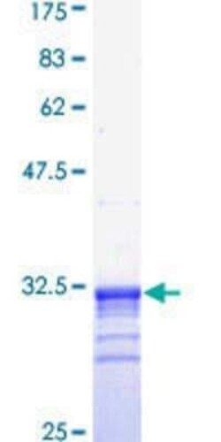 Novus Biologicals Recombinant Human Corticotropin Releasing Factor GST (N-Term) Protein 25 &mu;g | Buy Online | Novus Biologicals&trade; | Fisher Scientific
