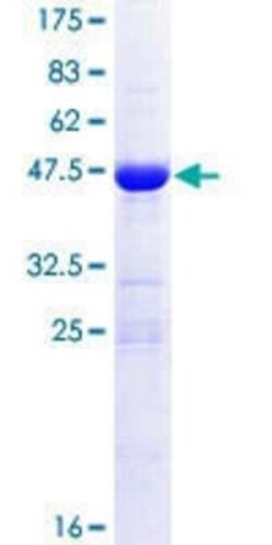 Novus Biologicals Recombinant Human CRIP2 GST (N-Term) Protein 10 &mu;g | Buy Online | Novus Biologicals&trade; | Fisher Scientific