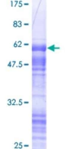 Novus Biologicals Recombinant Human CRX/CORD2 GST (N-Term) Protein 2 &mu;g | Buy Online | Novus Biologicals&trade; | Fisher Scientific