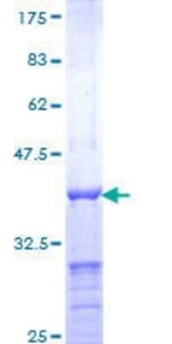 Novus Biologicals Recombinant Human CRX/CORD2 GST (N-Term) Protein 10 &mu;g | Buy Online | Novus Biologicals&trade; | Fisher Scientific