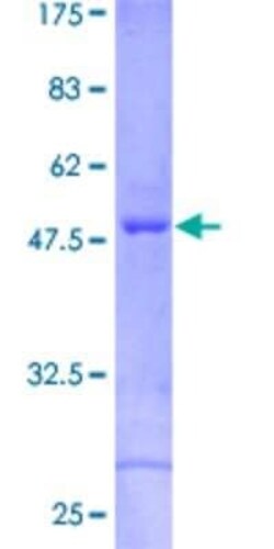 Novus Biologicals Recombinant Human CRYBA2 GST (N-Term) Protein 10 &mu;g | Buy Online | Novus Biologicals&trade; | Fisher Scientific