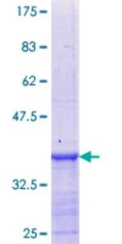 Novus Biologicals Recombinant Human CRYBA2 GST (N-Term) Protein 25 &mu;g | Buy Online | Novus Biologicals&trade; | Fisher Scientific
