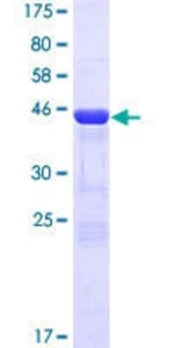 Novus Biologicals Recombinant Human CRYBB2 GST (N-Term) Protein 10 &mu;g | Buy Online | Novus Biologicals&trade; | Fisher Scientific
