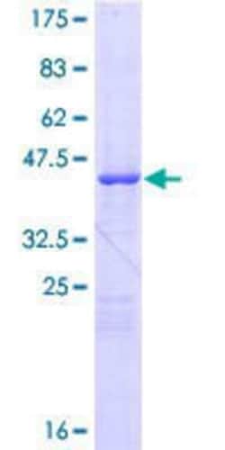 Novus Biologicals Recombinant Human CSE1L/CAS/Exportin-2 GST (N-Term) Protein 25 &mu;g | Buy Online | Novus Biologicals&trade; | Fisher Scientific
