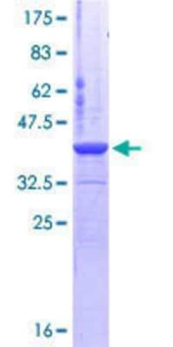 Novus Biologicals Recombinant Human CSE1L/CAS/Exportin-2 GST (N-Term) Protein 10 &mu;g | Buy Online | Novus Biologicals&trade; | Fisher Scientific