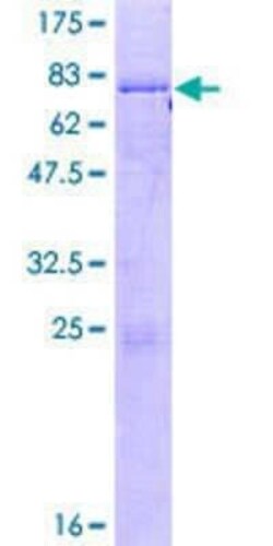 Novus Biologicals Recombinant Human Casein Kinase 1 epsilon GST (N-Term) Protein 2 &mu;g | Buy Online | Novus Biologicals&trade; | Fisher Scientific