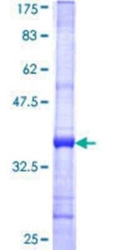 Novus Biologicals Recombinant Human Casein Kinase 1 epsilon GST (N-Term) Protein 25 &mu;g | Buy Online | Novus Biologicals&trade; | Fisher Scientific