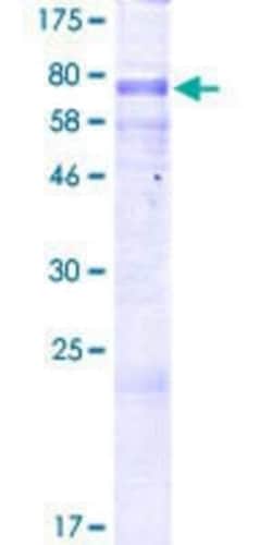Novus Biologicals Recombinant Human CKI gamma 3 GST (N-Term) Protein 2 &mu;g | Buy Online | Novus Biologicals&trade; | Fisher Scientific