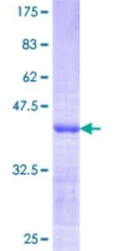 Novus Biologicals Recombinant Human CKI gamma 3 GST (N-Term) Protein 25 &mu;g | Buy Online | Novus Biologicals&trade; | Fisher Scientific