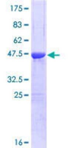Novus Biologicals Recombinant Human CSRP1 GST (N-Term) Protein 25 &mu;g | Buy Online | Novus Biologicals&trade; | Fisher Scientific