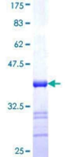Novus Biologicals Recombinant Human CSRP1 GST (N-Term) Protein 10 &mu;g | Buy Online | Novus Biologicals&trade; | Fisher Scientific