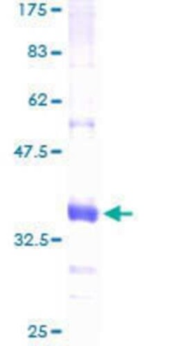 Novus Biologicals Recombinant Human Chitobiase/CTBS GST (N-Term) Protein 25 &mu;g | Buy Online | Novus Biologicals&trade; | Fisher Scientific