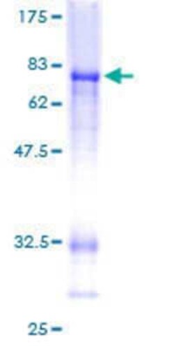 Novus Biologicals Recombinant Human CTBP2 GST (N-Term) Protein 25 &mu;g | Buy Online | Novus Biologicals&trade; | Fisher Scientific