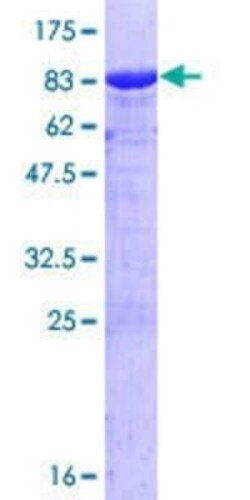 Novus Biologicals Recombinant Human Catenin alpha 1 GST (N-Term) Protein 25 &mu;g | Buy Online | Novus Biologicals&trade; | Fisher Scientific