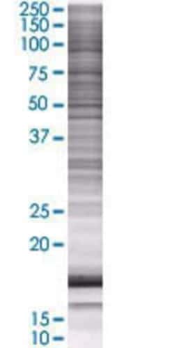 Novus Biologicals CTNS 293T Cell Transient Overexpression Lysate 0,1 mL | Buy Online | Novus Biologicals&trade; | Fisher Scientific