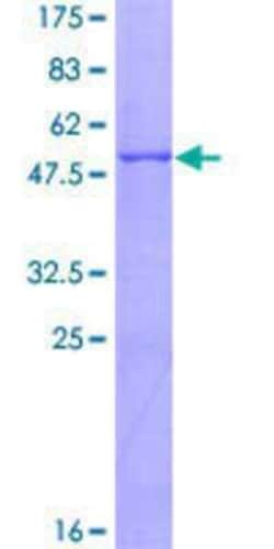 Novus Biologicals Recombinant Human CTRB1 GST (N-Term) Protein 25 &mu;g | Buy Online | Novus Biologicals&trade; | Fisher Scientific
