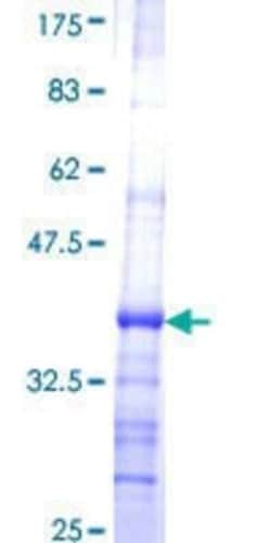 Novus Biologicals Recombinant Human CTRB1 GST (N-Term) Protein 25 &mu;g | Buy Online | Novus Biologicals&trade; | Fisher Scientific