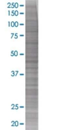 Novus Biologicals Cathepsin E 293T Cell Transient Overexpression Lysate 0.1 mL | Buy Online | Novus Biologicals&trade; | Fisher Scientific