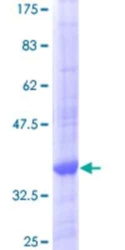 Novus Biologicals Recombinant Human Cathepsin K GST (N-Term) Protein 10 &mu;g | Buy Online | Novus Biologicals&trade; | Fisher Scientific