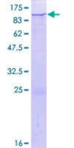 Novus Biologicals Recombinant Human CDP/CUTL1 GST (N-Term) Protein 2 &mu;g | Buy Online | Novus Biologicals&trade; | Fisher Scientific