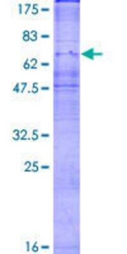 Novus Biologicals Recombinant Human CX3CR1 GST (N-Term) Protein 2 &mu;g | Buy Online | Novus Biologicals&trade; | Fisher Scientific