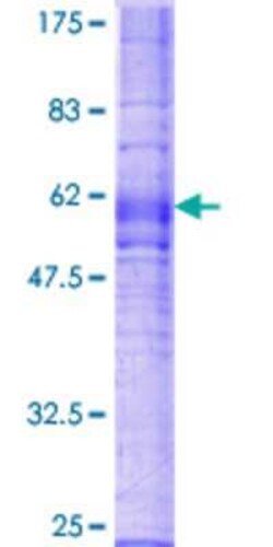 Novus Biologicals Recombinant Human CX3CR1 GST (N-Term) Protein 2 &mu;g | Buy Online | Novus Biologicals&trade; | Fisher Scientific